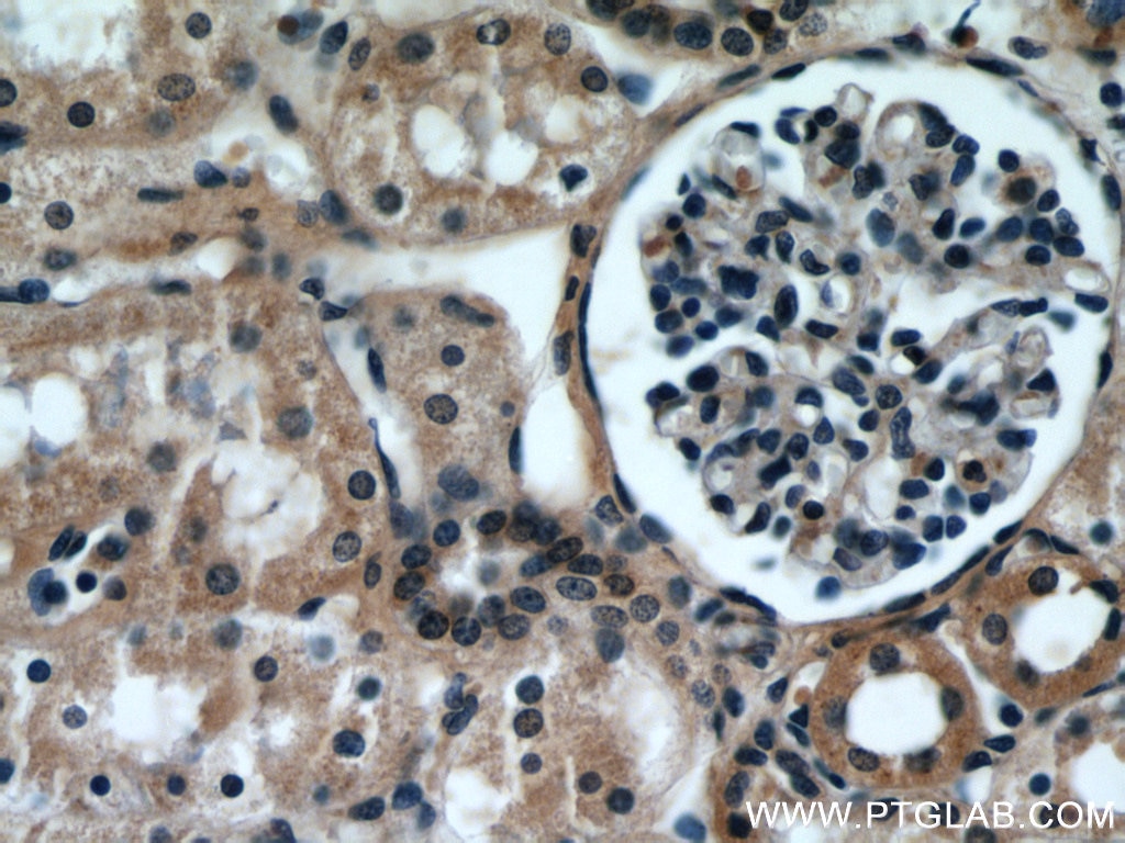 IHC staining of human kidney using 21921-1-AP