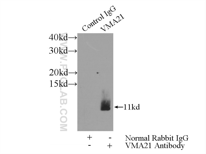 Immunoprecipitation (IP) experiment of MCF-7 cells using VMA21 Polyclonal antibody (21921-1-AP)