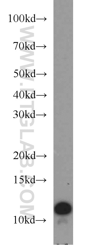 Western Blot (WB) analysis of MCF-7 cells using VMA21 Polyclonal antibody (21921-1-AP)