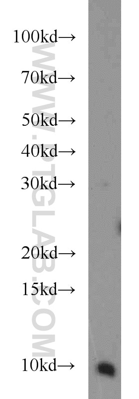 Western Blot (WB) analysis of human placenta tissue using VMA21 Polyclonal antibody (21921-1-AP)