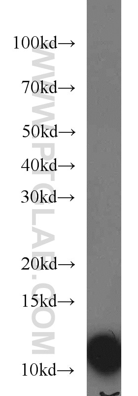 Western Blot (WB) analysis of mouse thymus tissue using VMA21 Polyclonal antibody (21921-1-AP)