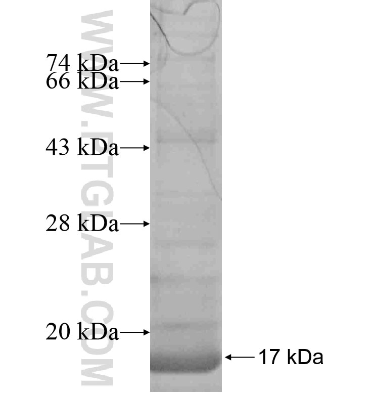 VMA21 fusion protein Ag16872 SDS-PAGE