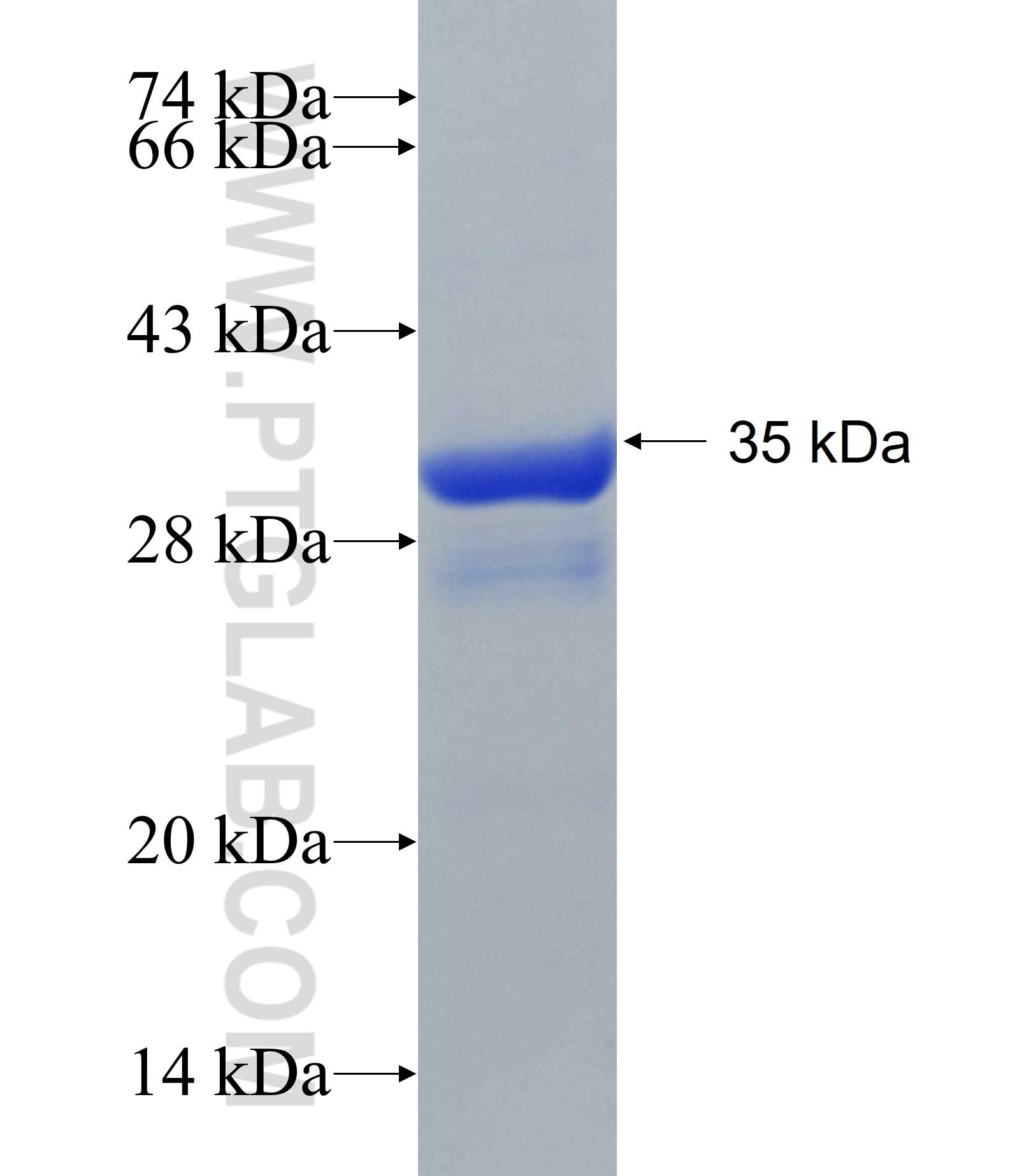 VMA21 fusion protein Ag16439 SDS-PAGE