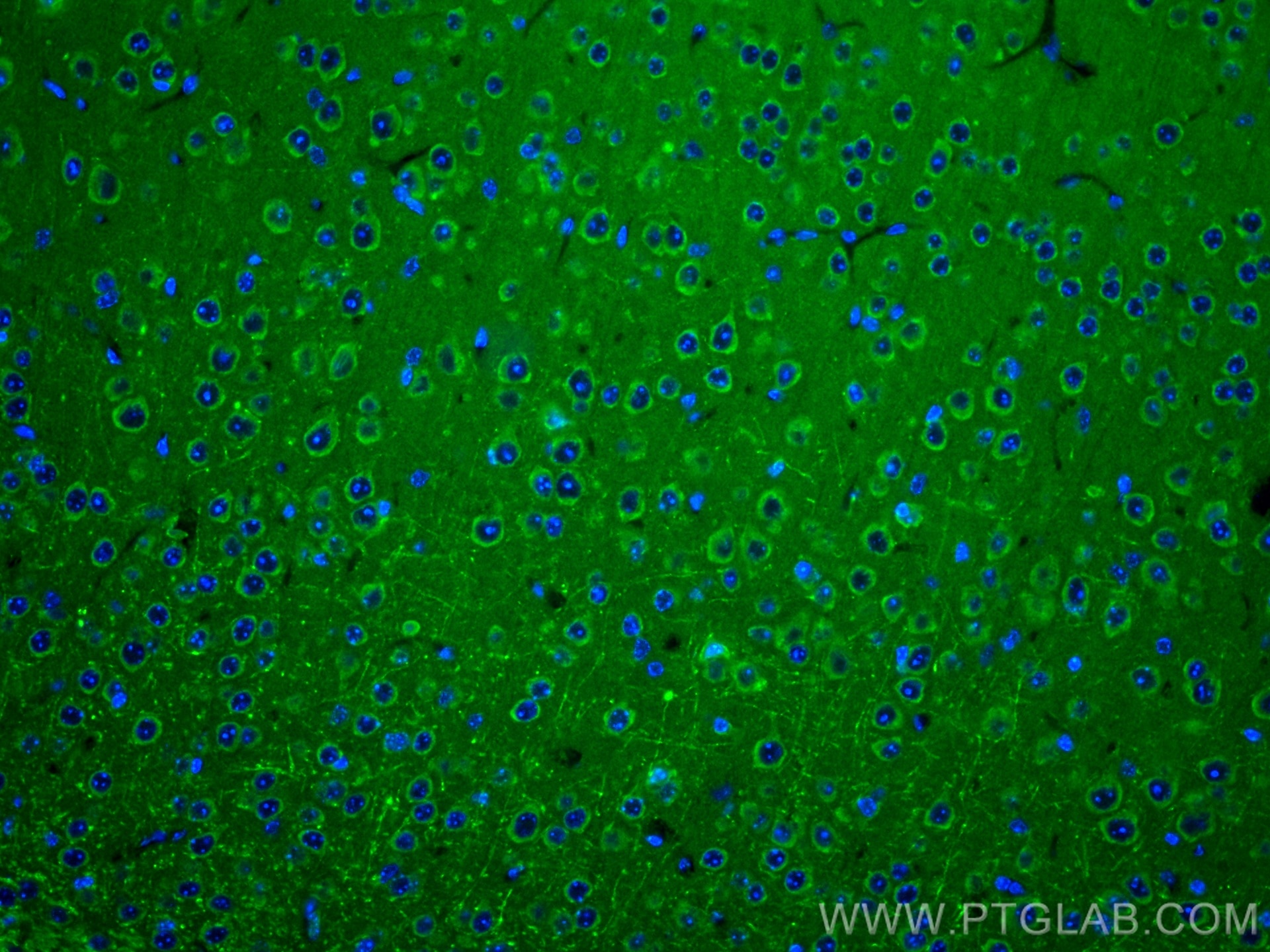 Immunofluorescence (IF) / fluorescent staining of mouse brain tissue using VMAT2 Polyclonal antibody (20873-1-AP)