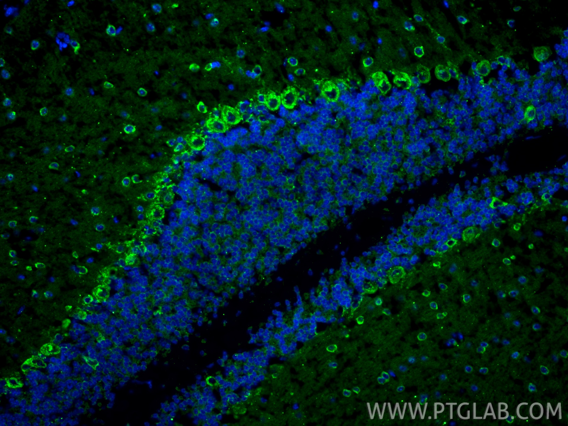 Immunofluorescence (IF) / fluorescent staining of mouse cerebellum tissue using VMAT2 Polyclonal antibody (20873-1-AP)