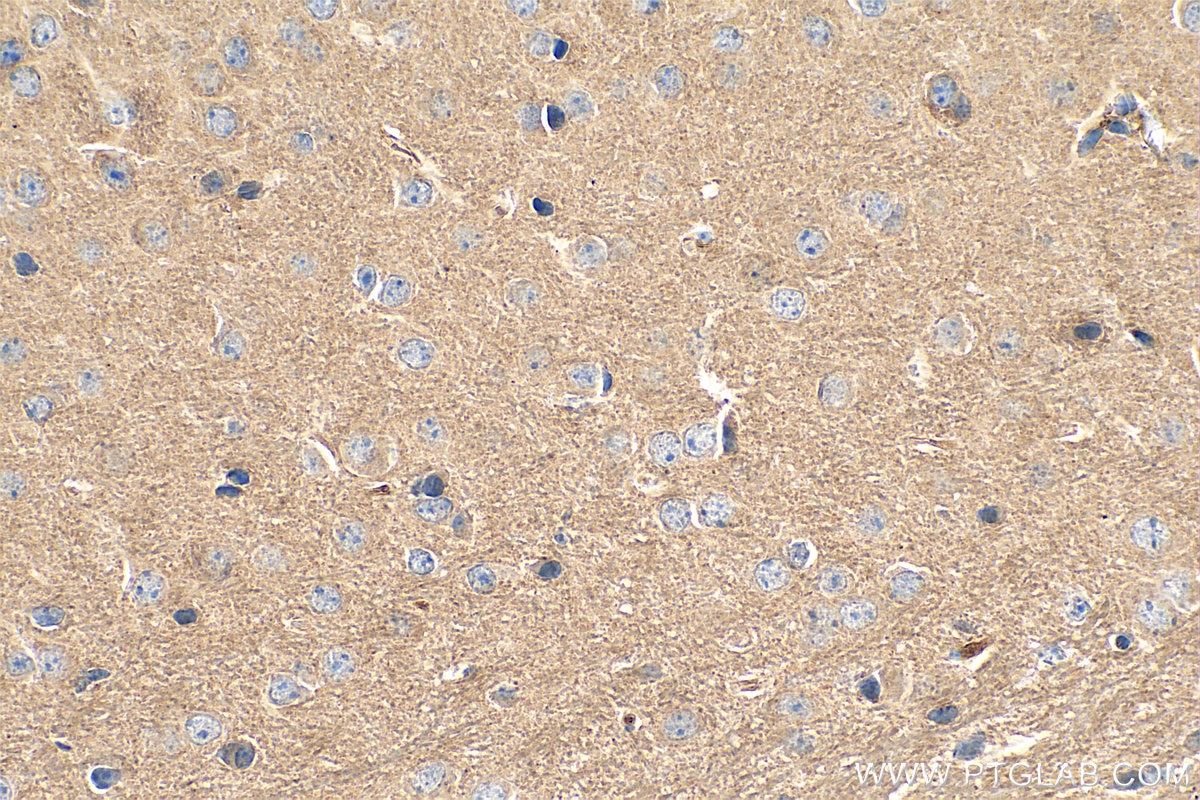 Immunohistochemistry (IHC) staining of mouse brain tissue using VMAT2 Polyclonal antibody (20873-1-AP)