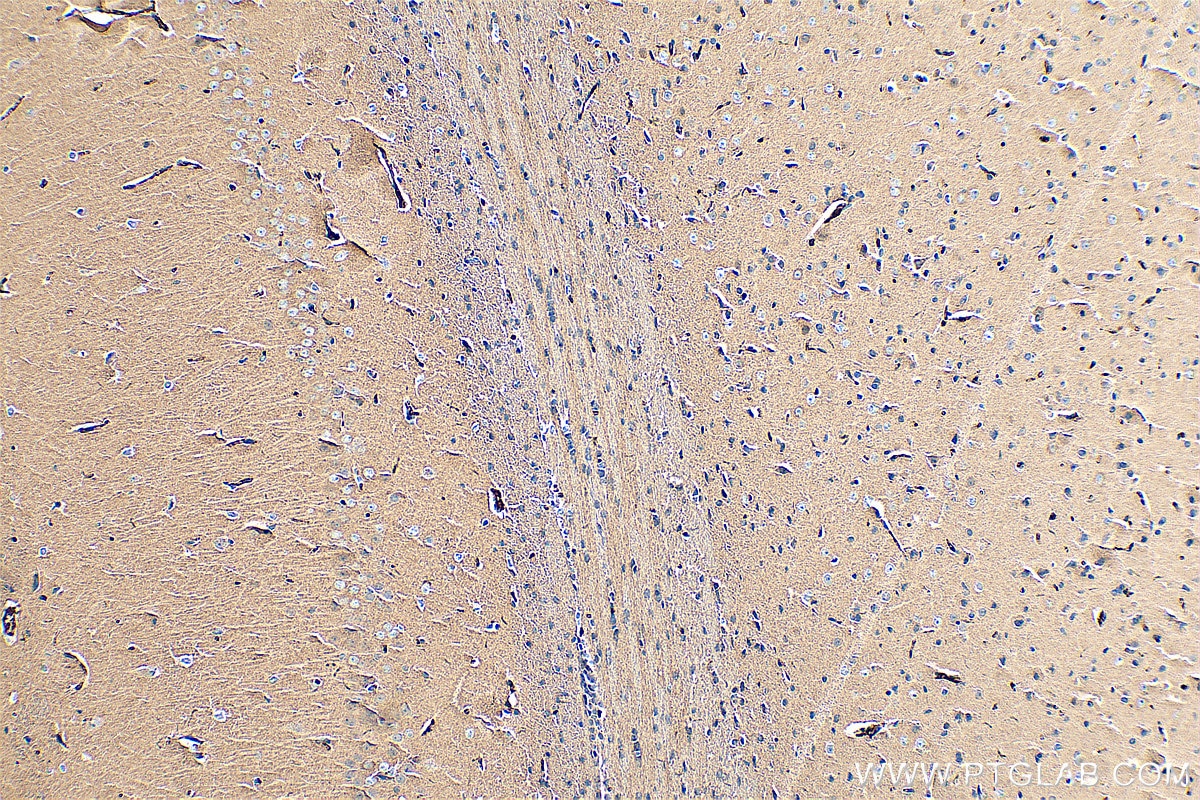 Immunohistochemistry (IHC) staining of rat brain tissue using VMAT2 Polyclonal antibody (20873-1-AP)