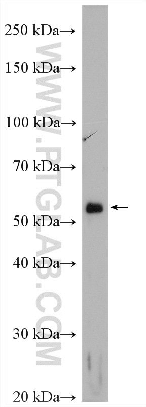Western Blot (WB) analysis of SGC-7901 cells using VMAT2 Polyclonal antibody (20873-1-AP)