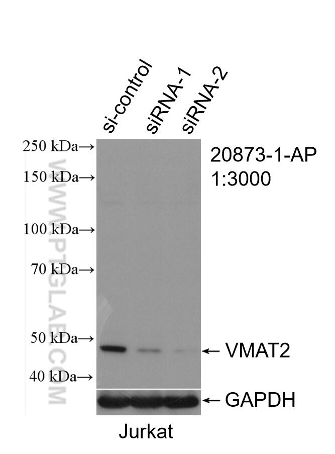 Western Blot (WB) analysis of Jurkat cells using VMAT2 Polyclonal antibody (20873-1-AP)