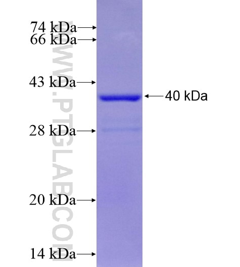 VMAT2 fusion protein Ag14971 SDS-PAGE