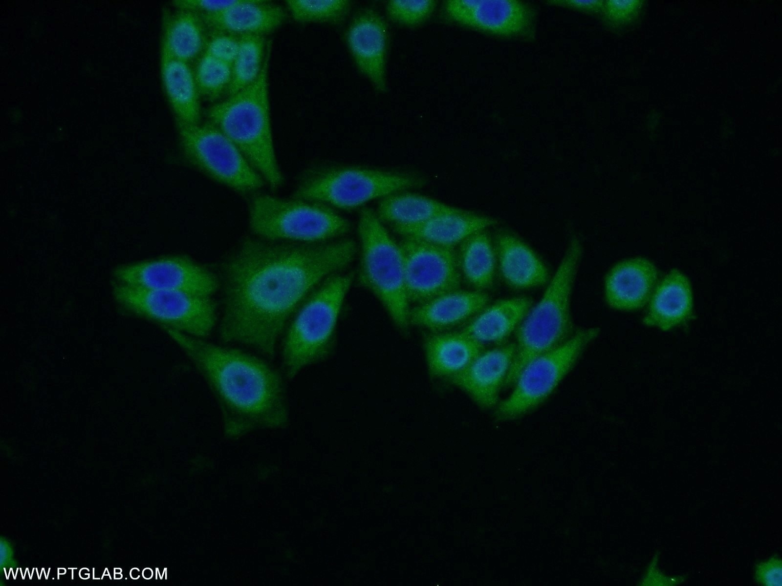 Immunofluorescence (IF) / fluorescent staining of HeLa cells using VMO1 Polyclonal antibody (21577-1-AP)