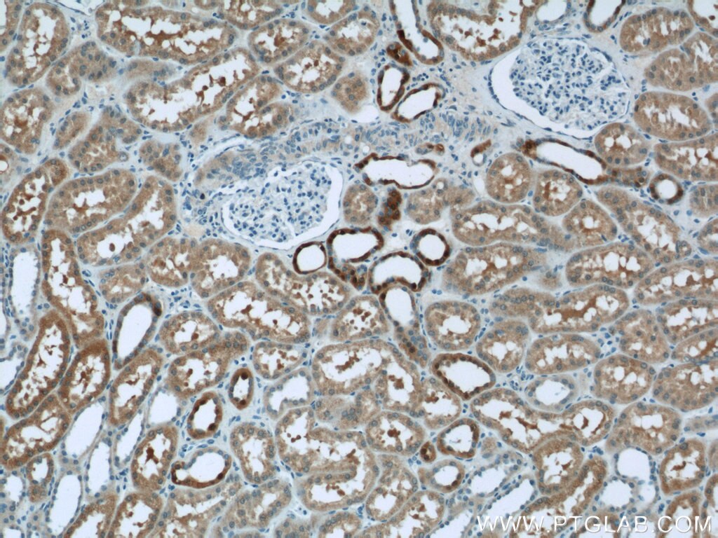 Immunohistochemistry (IHC) staining of human kidney tissue using VMO1 Polyclonal antibody (21577-1-AP)
