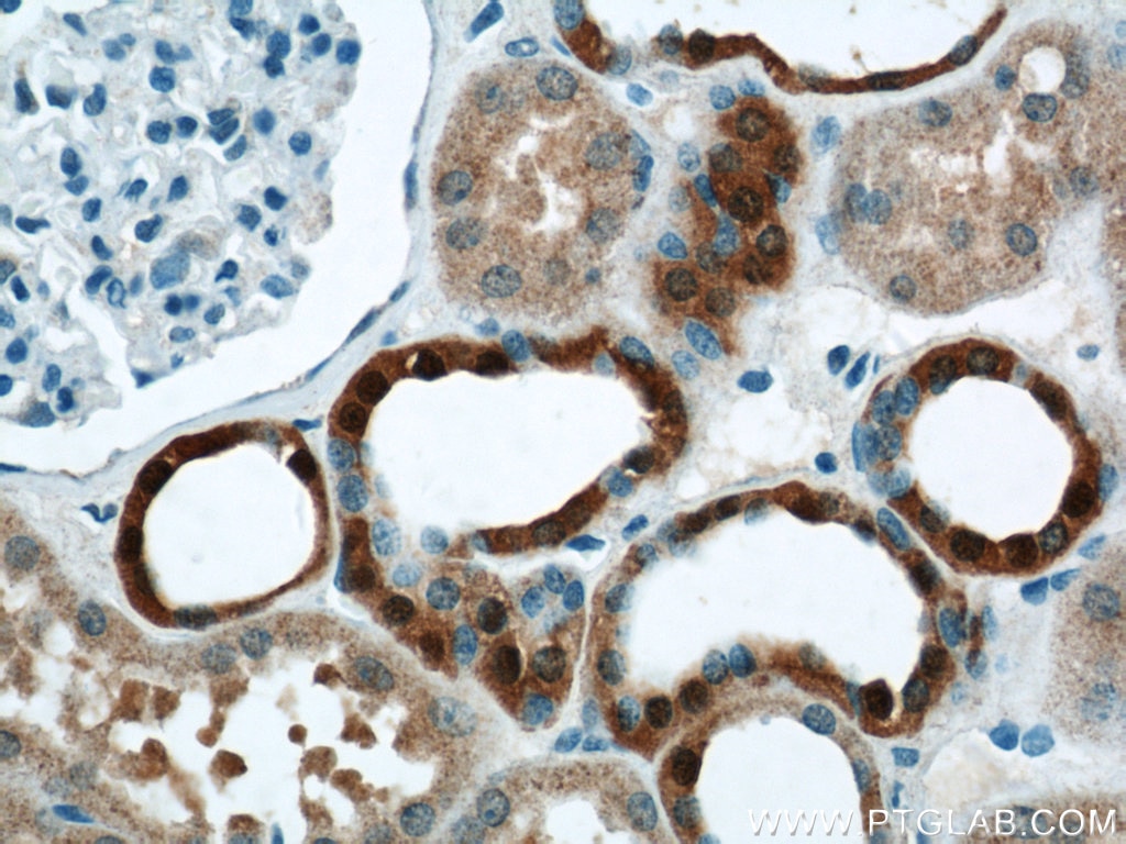 Immunohistochemistry (IHC) staining of human kidney tissue using VMO1 Polyclonal antibody (21577-1-AP)