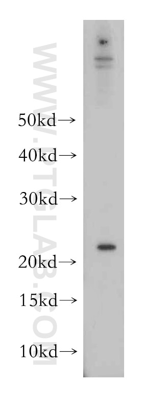 Western Blot (WB) analysis of HEK-293 cells using VMO1 Polyclonal antibody (21577-1-AP)