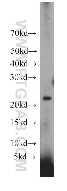 Western Blot (WB) analysis of HeLa cells using VMO1 Polyclonal antibody (21577-1-AP)