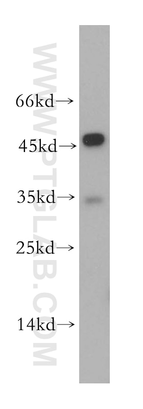 Western Blot (WB) analysis of HeLa cells using VN1R4 Polyclonal antibody (18846-1-AP)