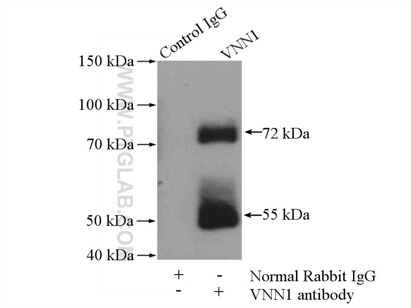 Immunoprecipitation (IP) experiment of mouse kidney tissue using VNN1 Polyclonal antibody (21745-1-AP)