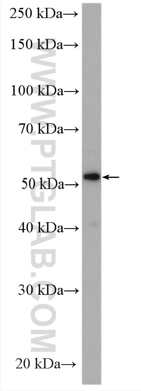 Western Blot (WB) analysis of BxPC-3 cells using VNN1 Polyclonal antibody (21745-1-AP)