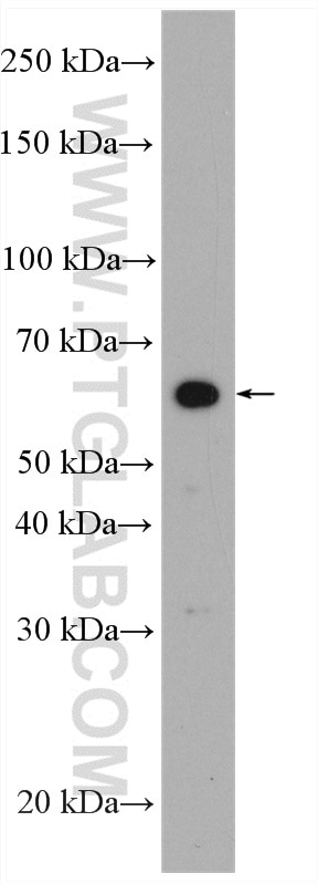 Western Blot (WB) analysis of BxPC-3 cells using VNN1 Polyclonal antibody (21745-1-AP)