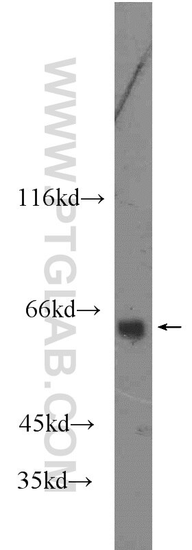 Western Blot (WB) analysis of mouse kidney tissue using VNN1 Polyclonal antibody (21745-1-AP)