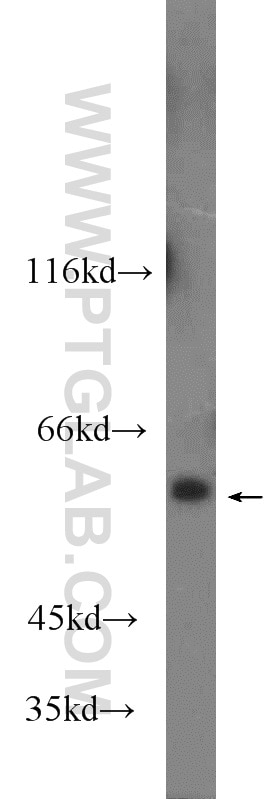 Western Blot (WB) analysis of PC-13 cells using VNN1 Polyclonal antibody (21745-1-AP)