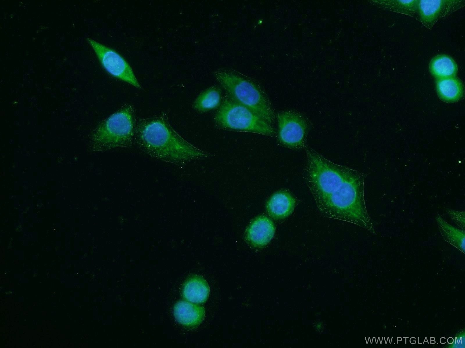 Immunofluorescence (IF) / fluorescent staining of HeLa cells using VNN2 Polyclonal antibody (25643-1-AP)