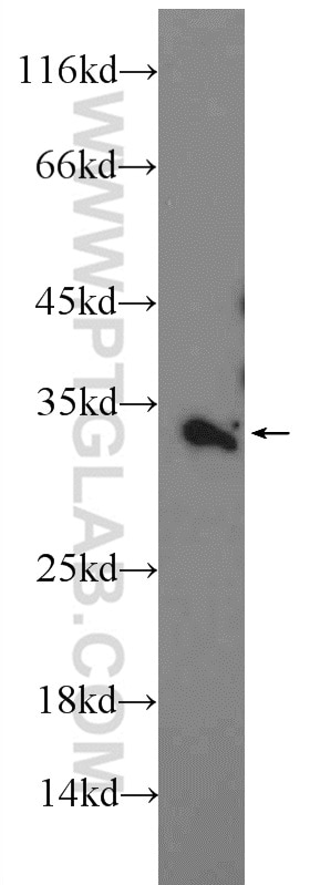 Western Blot (WB) analysis of HeLa cells using VNN2 Polyclonal antibody (25643-1-AP)