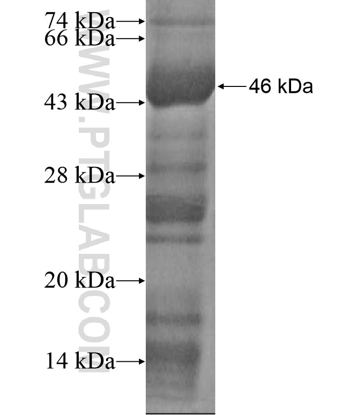 VP7 fusion protein Ag17616 SDS-PAGE