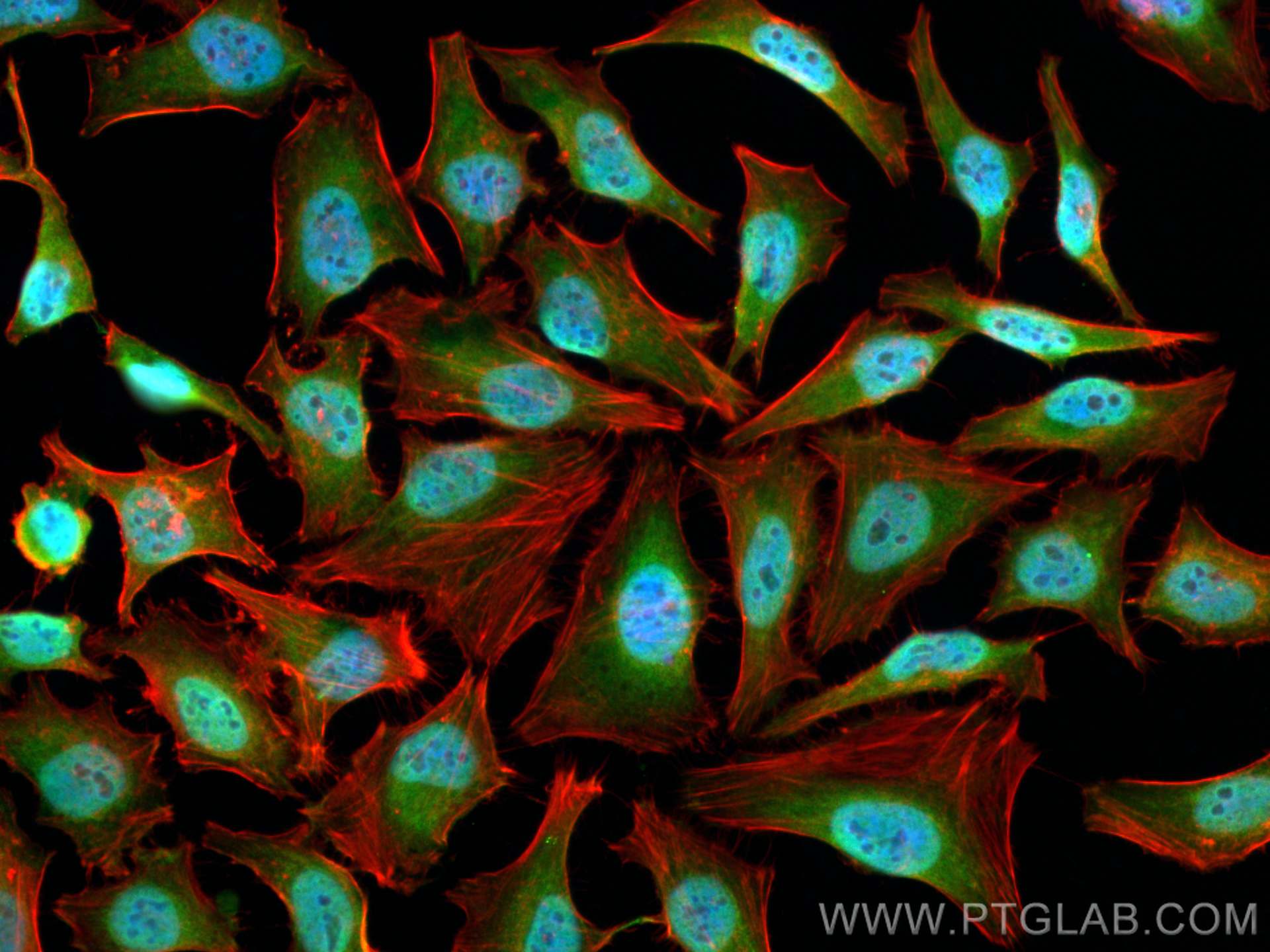 Immunofluorescence (IF) / fluorescent staining of HeLa cells using VPRBP Polyclonal antibody (11612-1-AP)