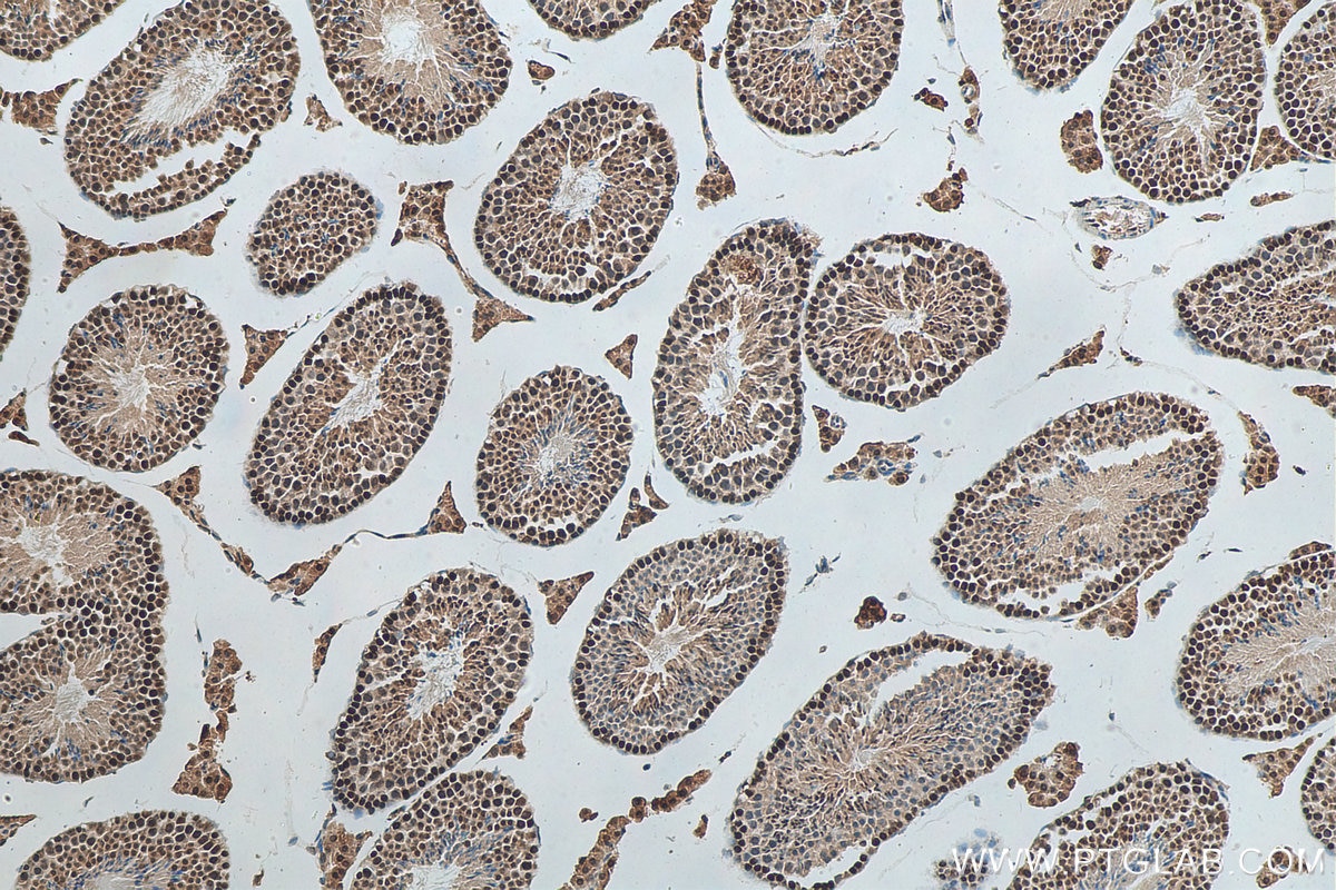 Immunohistochemistry (IHC) staining of mouse testis tissue using VPRBP Polyclonal antibody (11612-1-AP)