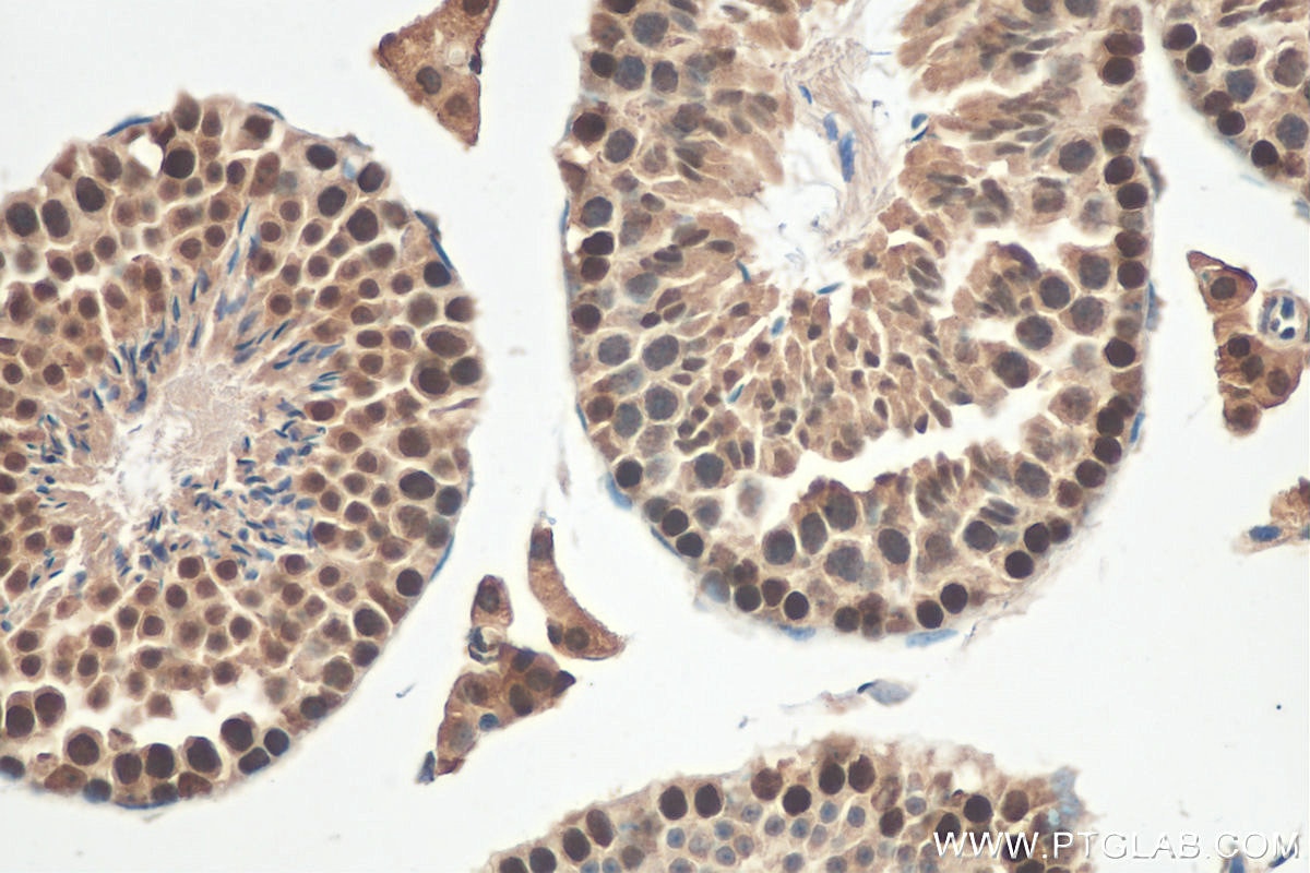 Immunohistochemistry (IHC) staining of mouse testis tissue using VPRBP Polyclonal antibody (11612-1-AP)