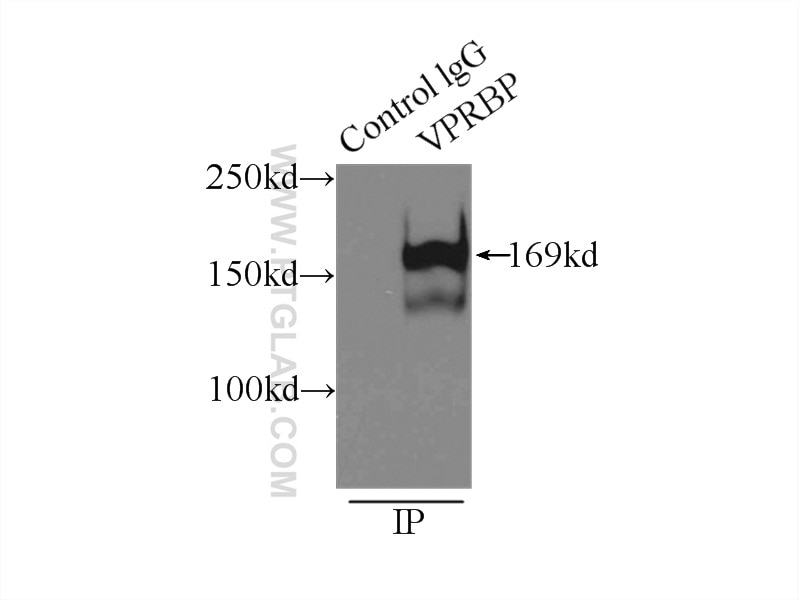Immunoprecipitation (IP) experiment of HeLa cells using VPRBP Polyclonal antibody (11612-1-AP)