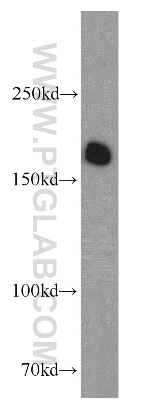 Western Blot (WB) analysis of HeLa cells using VPRBP Polyclonal antibody (11612-1-AP)