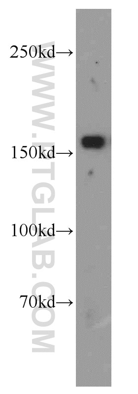 Western Blot (WB) analysis of K-562 cells using VPRBP Polyclonal antibody (11612-1-AP)