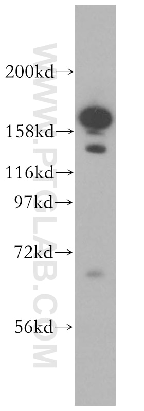 Western Blot (WB) analysis of PC-3 cells using VPRBP Polyclonal antibody (11612-1-AP)