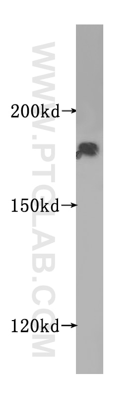 Western Blot (WB) analysis of mouse testis tissue using VPRBP Polyclonal antibody (11612-1-AP)