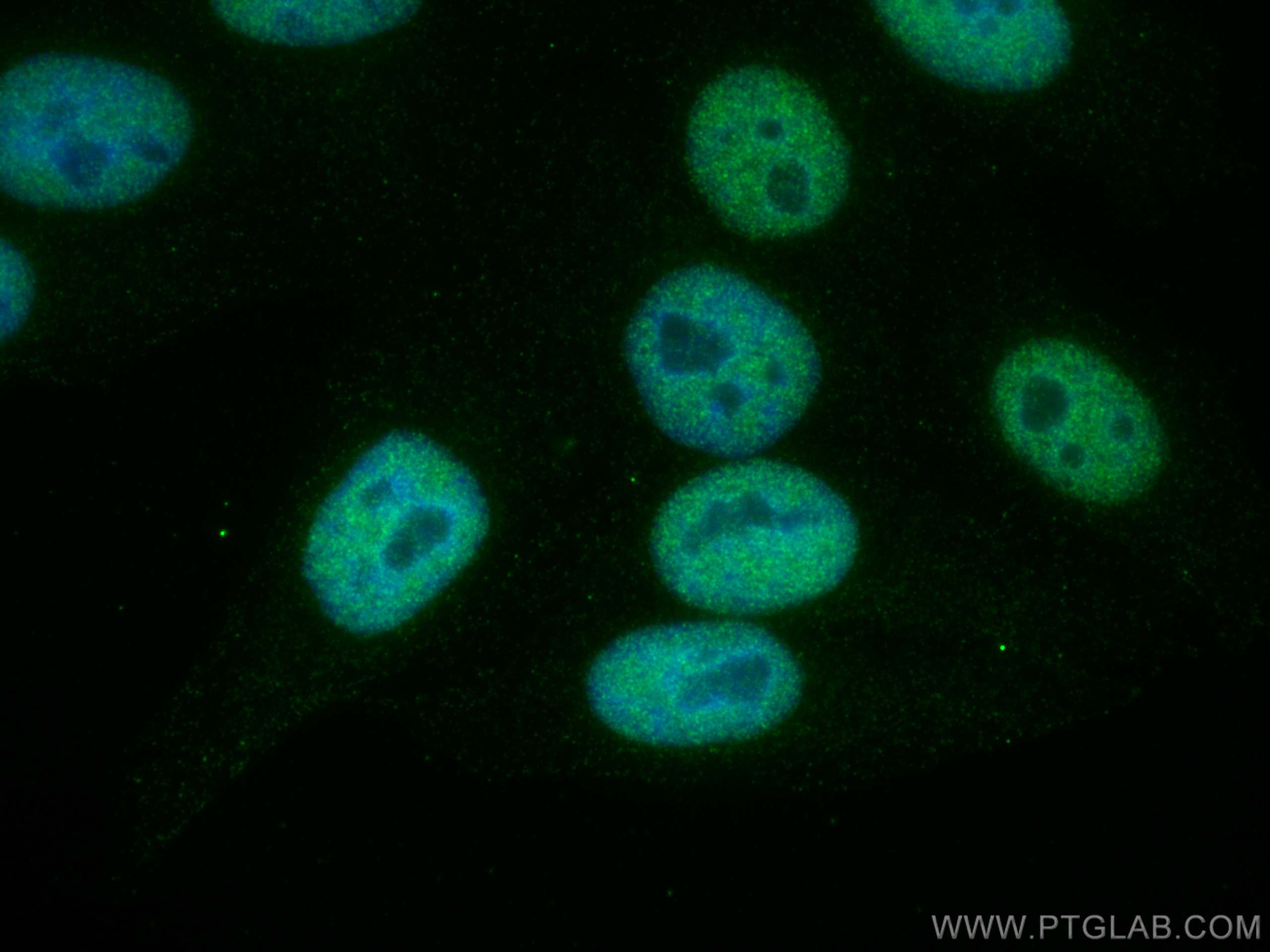 Immunofluorescence (IF) / fluorescent staining of HepG2 cells using VPRBP Monoclonal antibody (66392-1-Ig)
