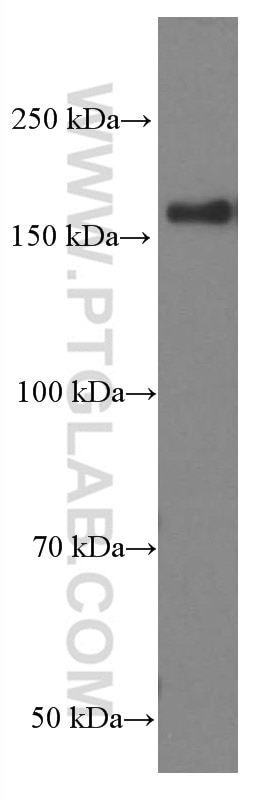 Western Blot (WB) analysis of HeLa cells using VPRBP Monoclonal antibody (66392-1-Ig)