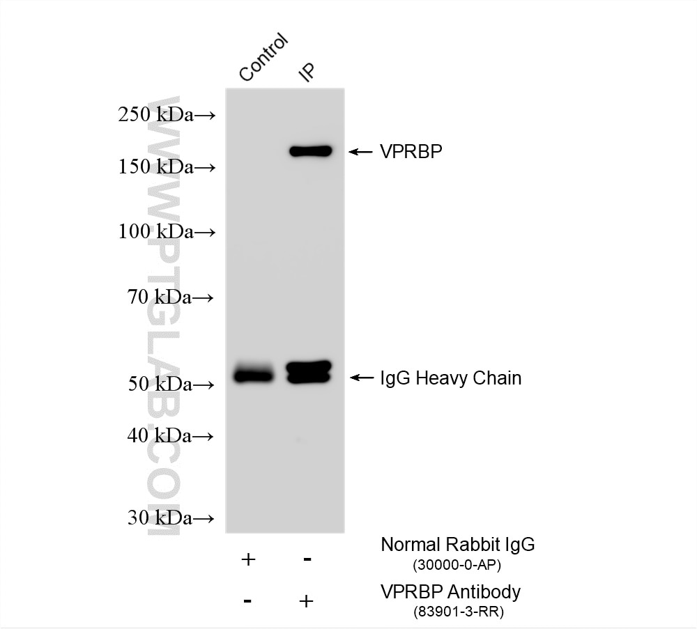 Immunoprecipitation (IP) experiment of HEK-293 cells using VPRBP Recombinant monoclonal antibody (83901-3-RR)