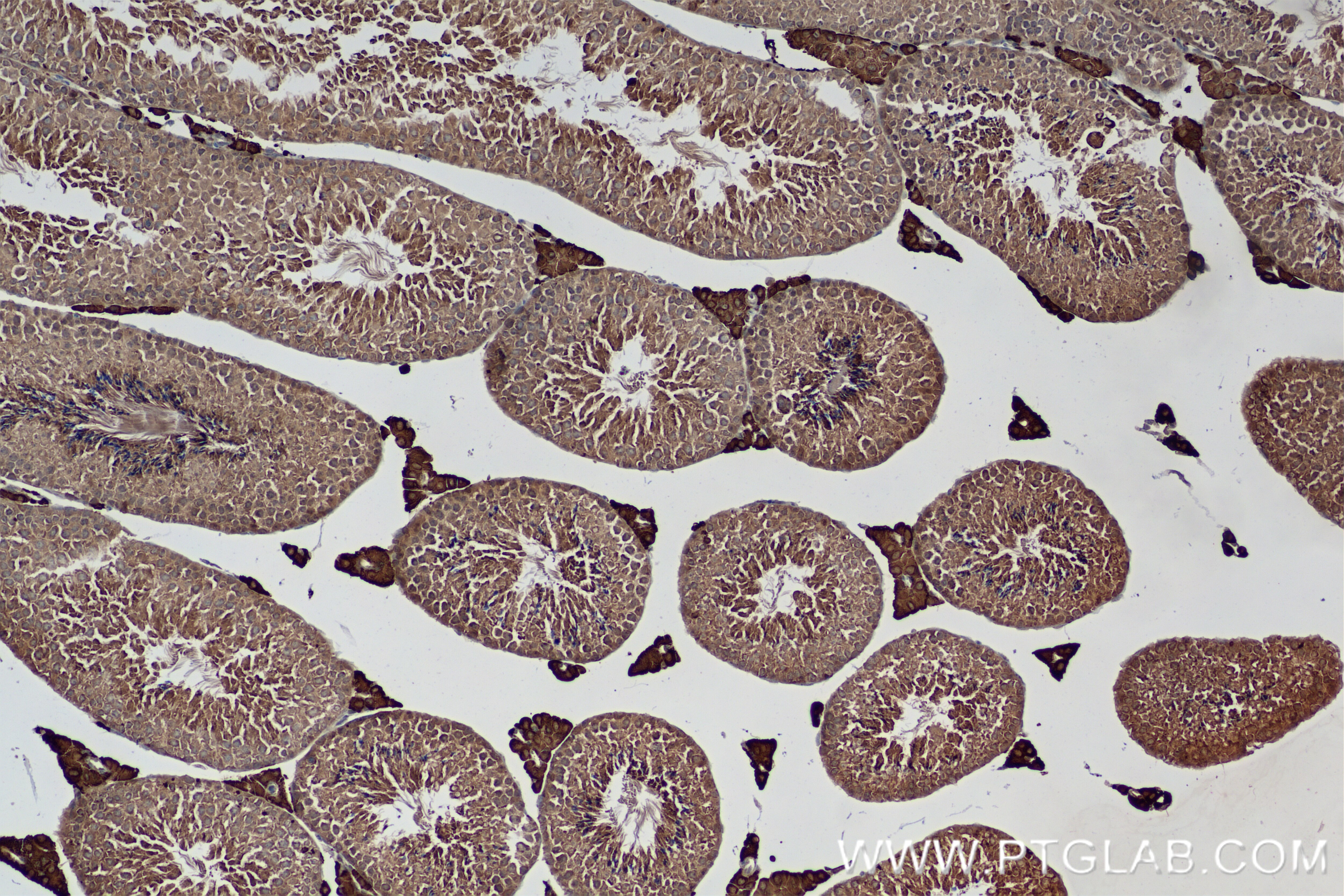 Immunohistochemistry (IHC) staining of mouse testis tissue using VPRBP Recombinant antibody (83901-5-RR)
