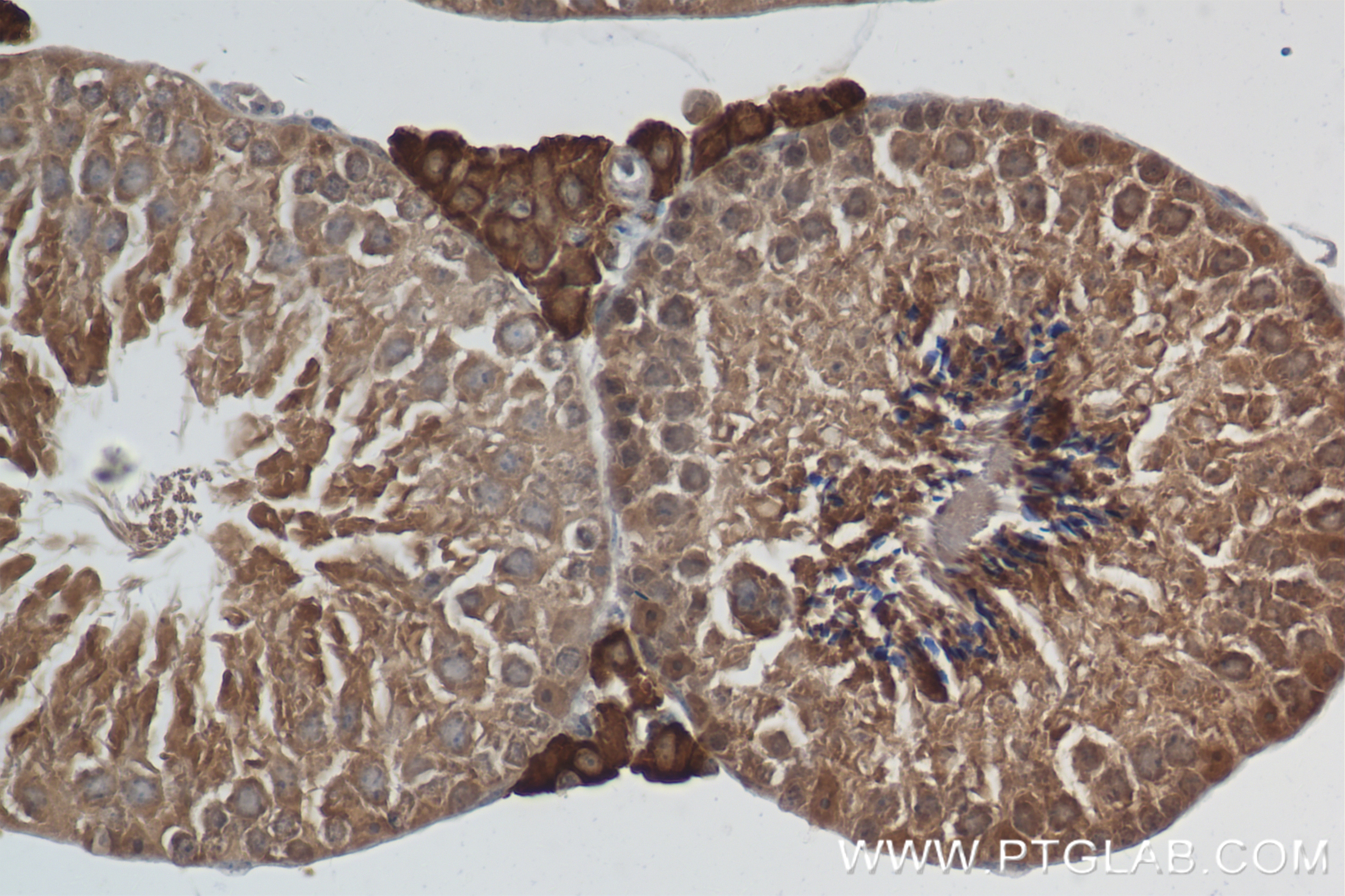 Immunohistochemistry (IHC) staining of mouse testis tissue using VPRBP Recombinant antibody (83901-5-RR)