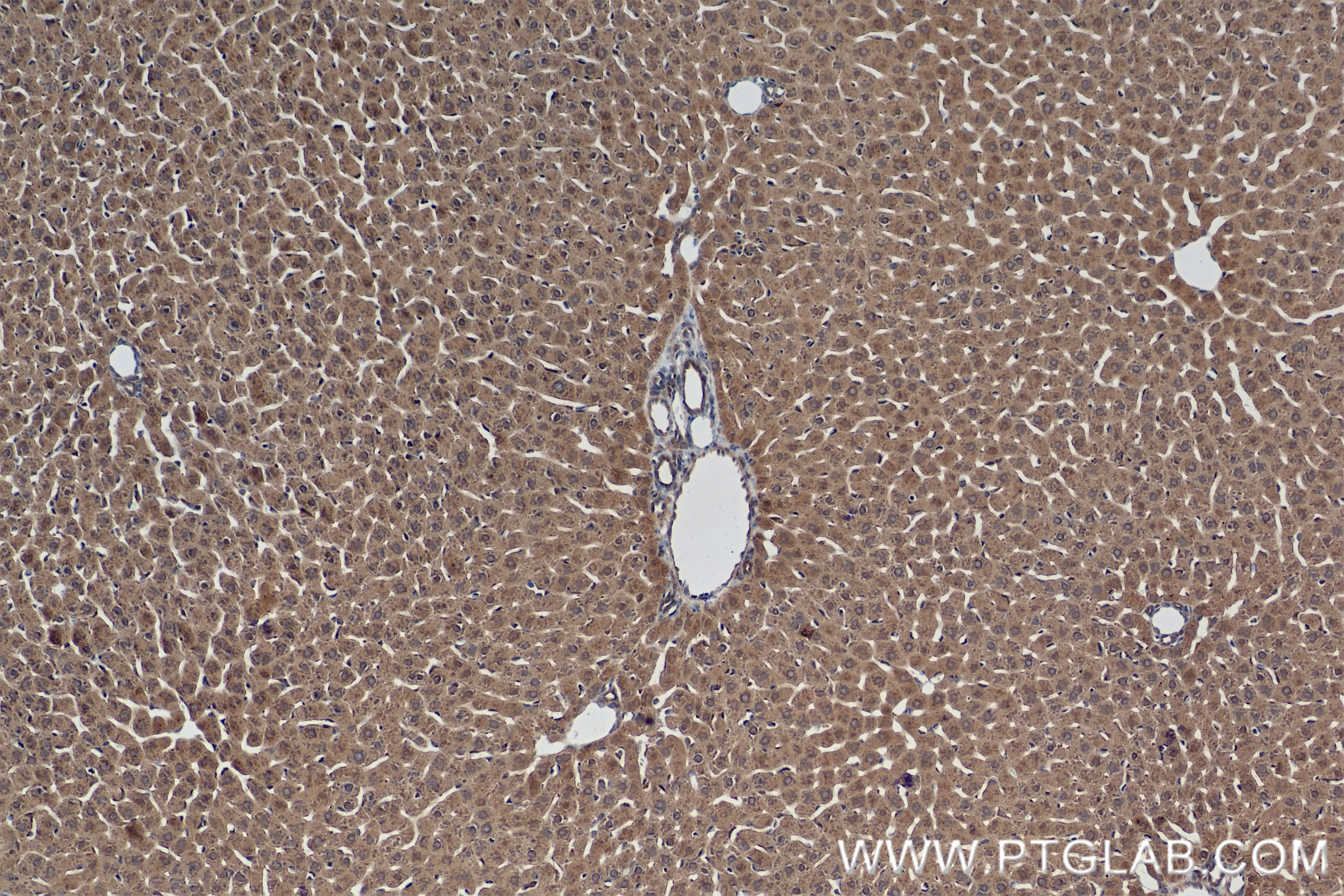 Immunohistochemistry (IHC) staining of rat liver tissue using VPRBP Recombinant antibody (83901-5-RR)
