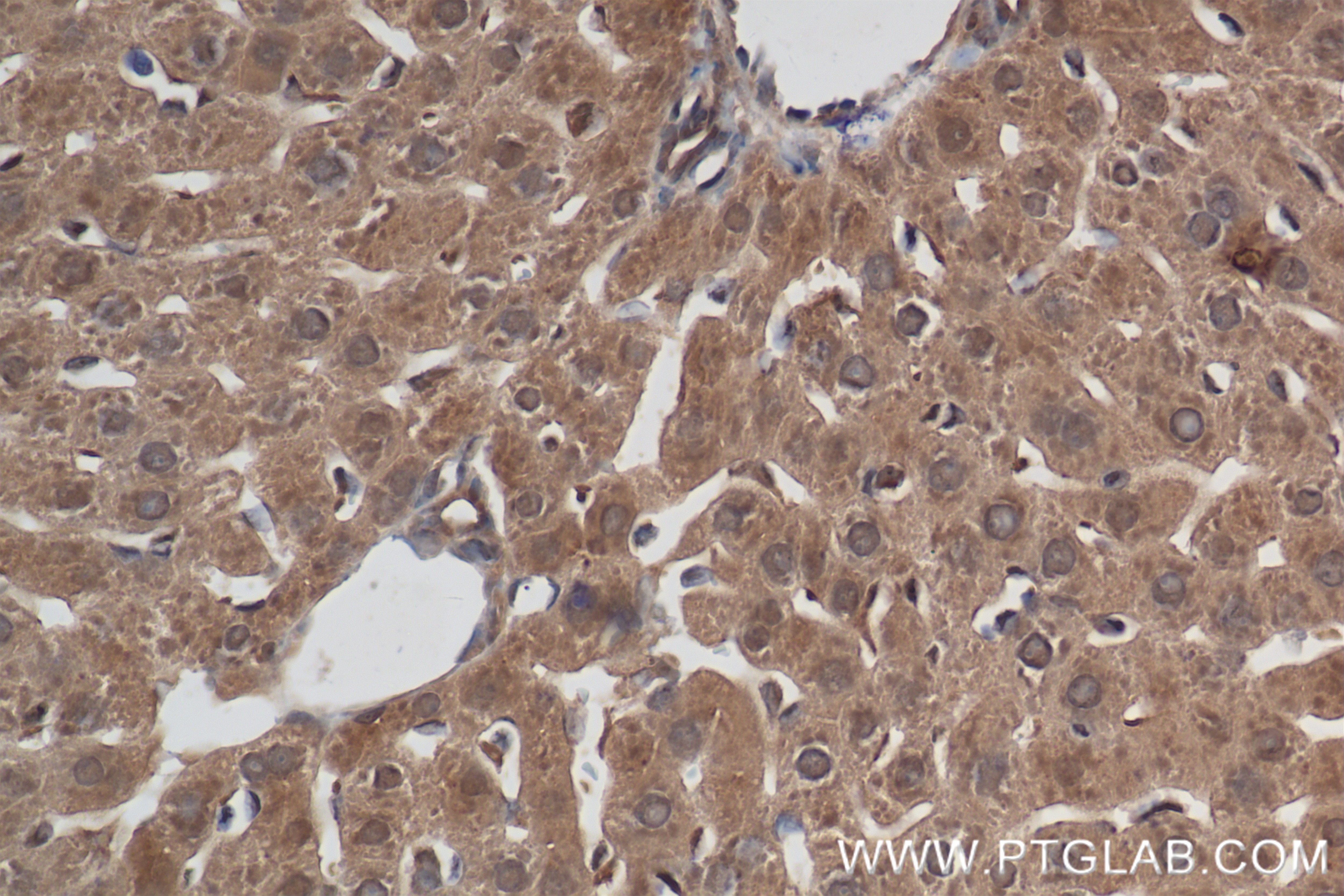 Immunohistochemistry (IHC) staining of rat liver tissue using VPRBP Recombinant antibody (83901-5-RR)