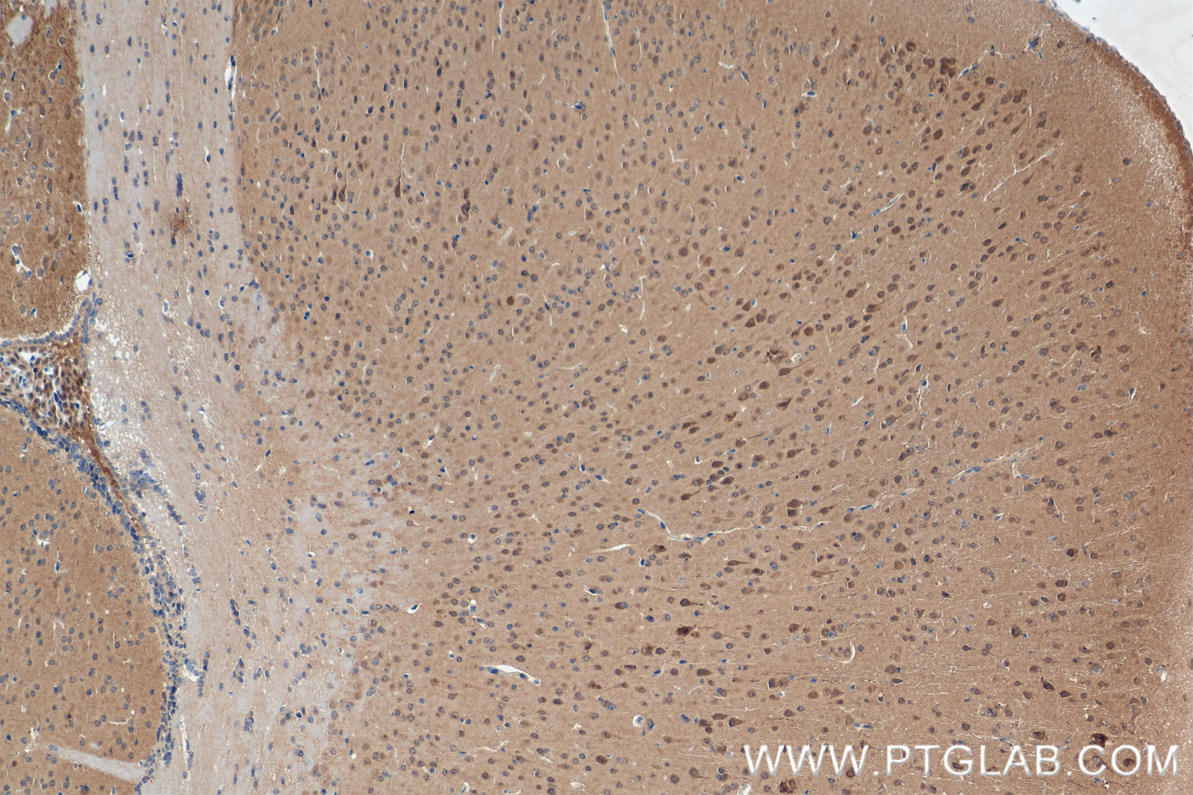 Immunohistochemistry (IHC) staining of mouse brain tissue using VPRBP Recombinant antibody (83901-5-RR)