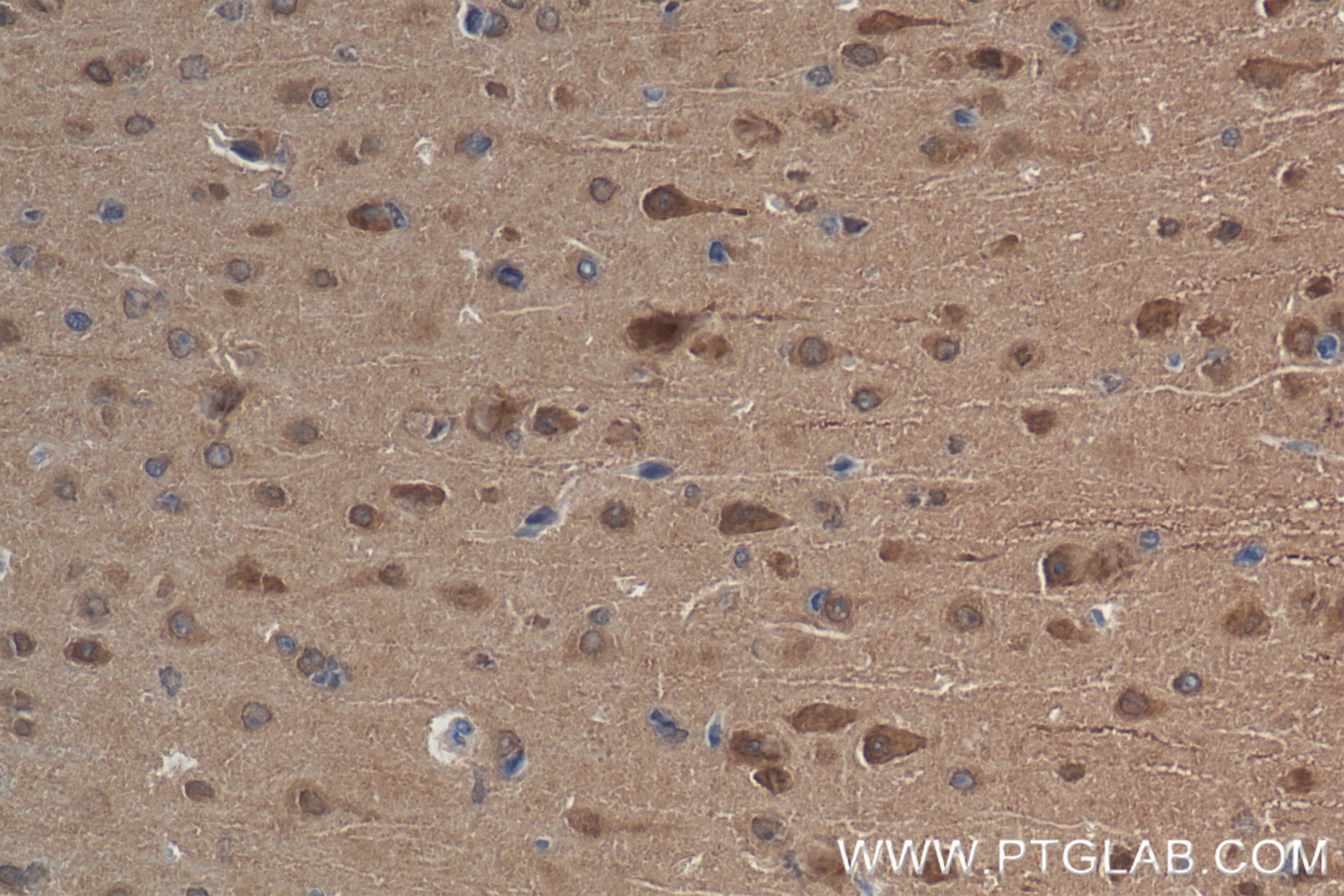 Immunohistochemistry (IHC) staining of mouse brain tissue using VPRBP Recombinant antibody (83901-5-RR)