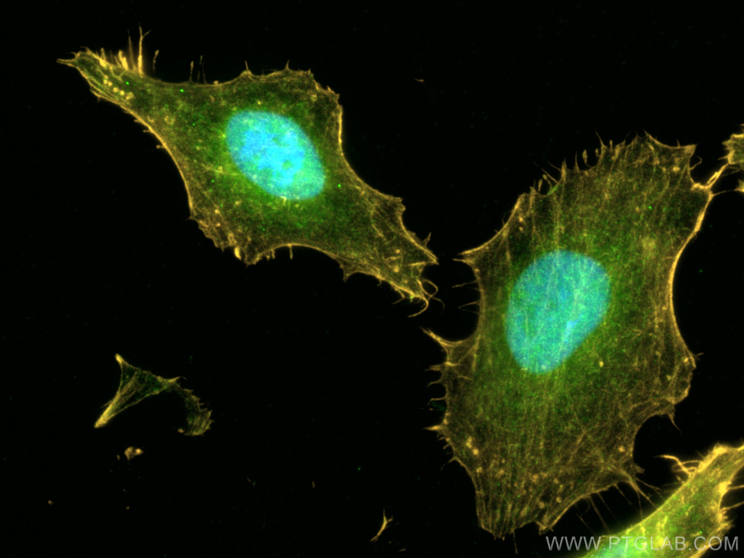 IF Staining of HeLa using CL488-11612