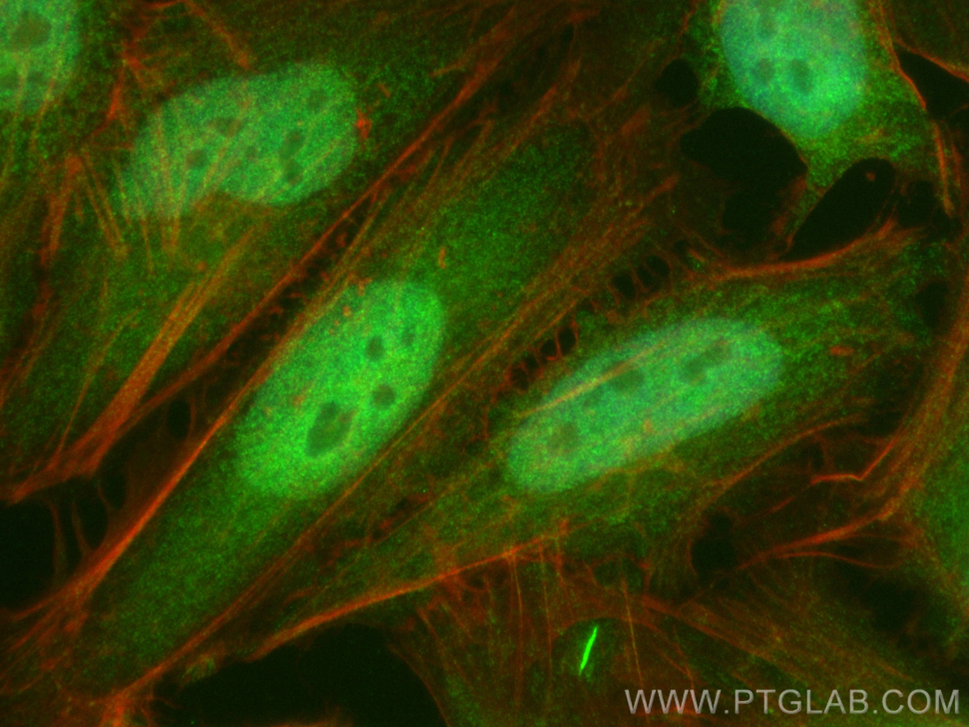 Immunofluorescence (IF) / fluorescent staining of HeLa cells using CoraLite® Plus 488-conjugated VPRBP Polyclonal ant (CL488-11612)