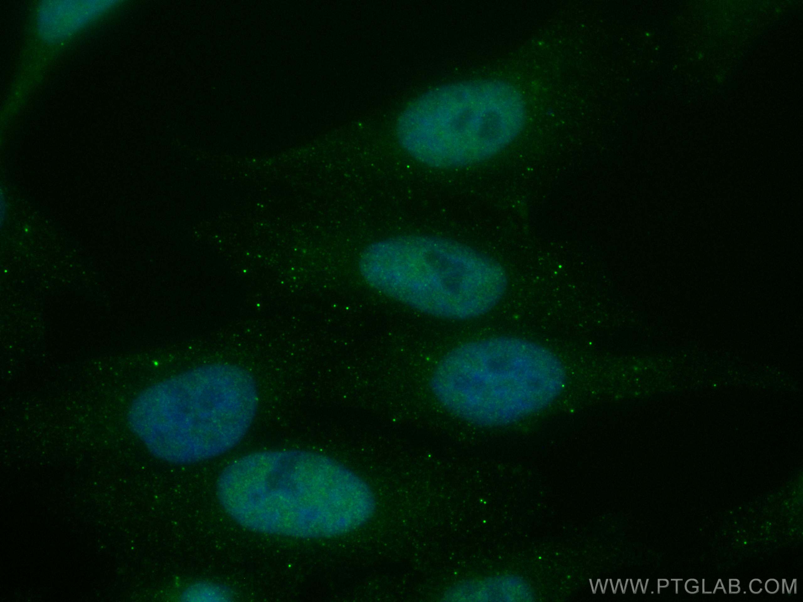Immunofluorescence (IF) / fluorescent staining of HepG2 cells using CoraLite® Plus 488-conjugated VPRBP Monoclonal ant (CL488-66392)