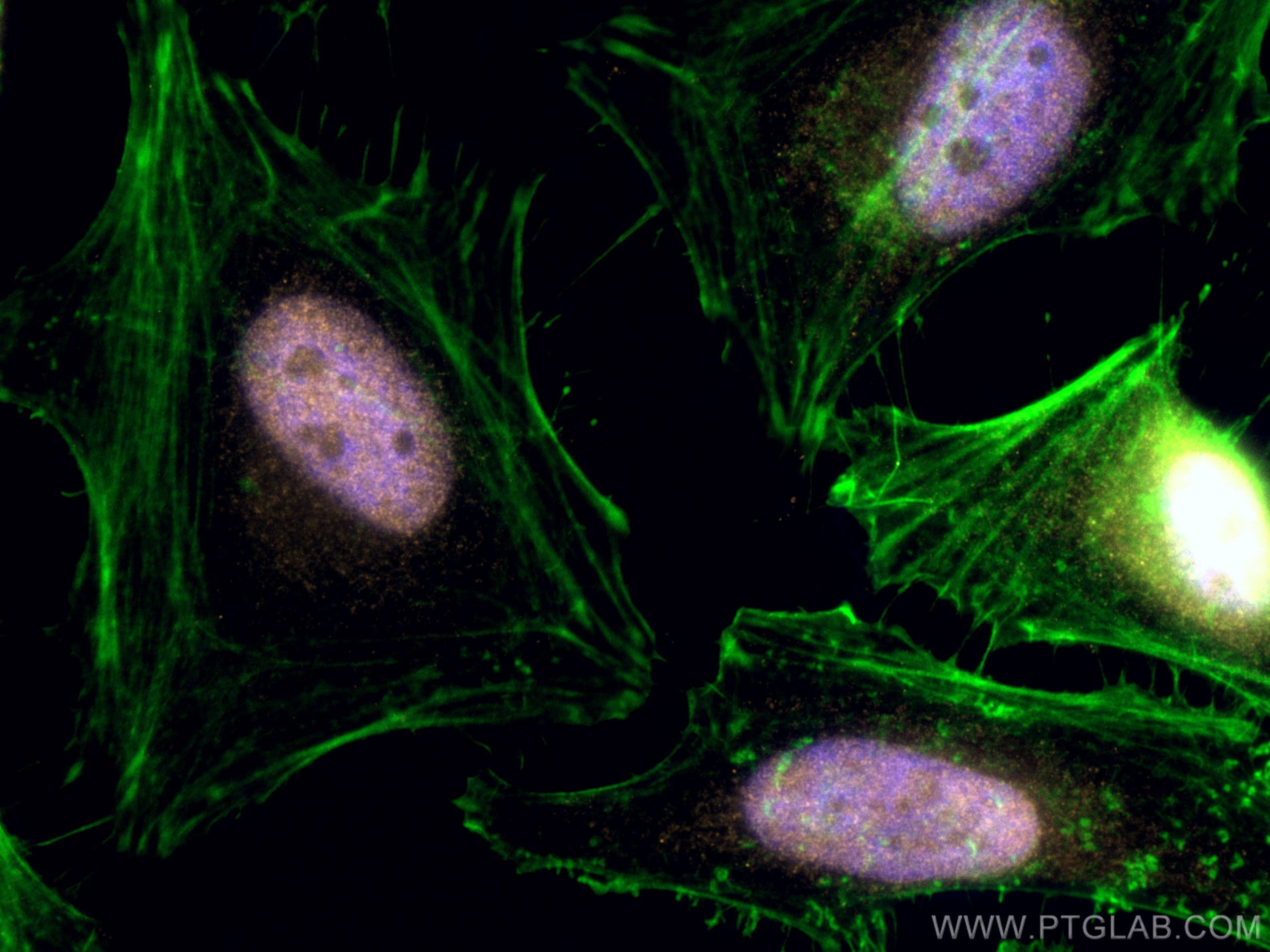 Immunofluorescence (IF) / fluorescent staining of HeLa cells using CoraLite®555-conjugated VPRBP Polyclonal antibody (CL555-11612)