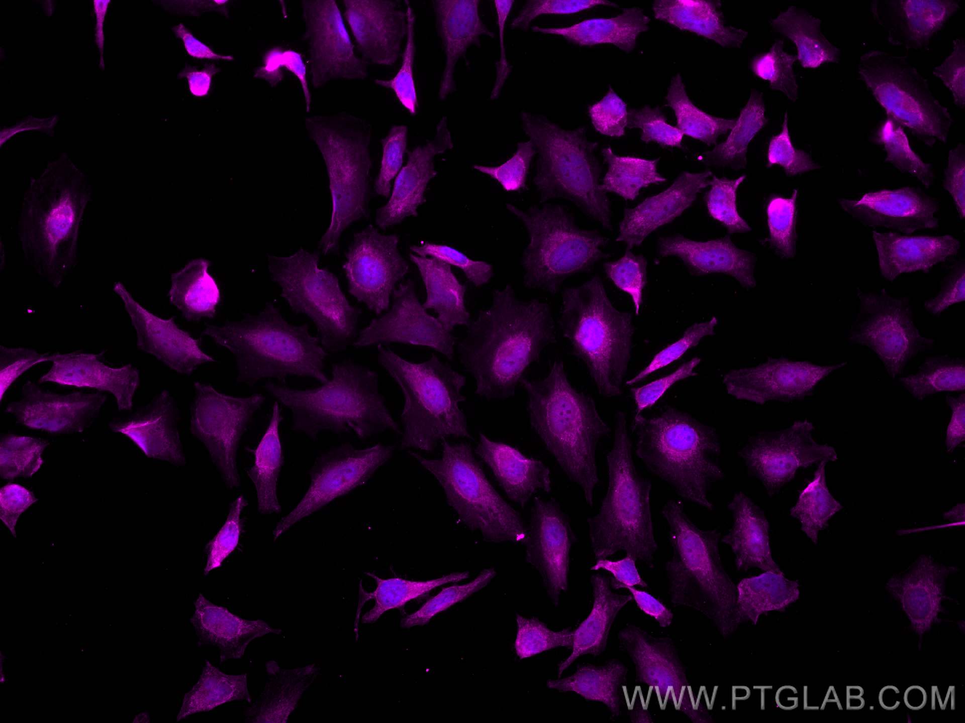 Immunofluorescence (IF) / fluorescent staining of HeLa cells using CoraLite® Plus 647-conjugated VPRBP Polyclonal ant (CL647-11612)